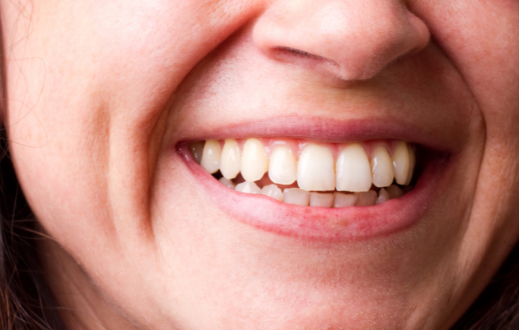 为什么小朋友的牙齿会变黑，应该怎么样处理呢？